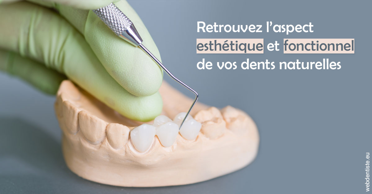 https://dr-laupie-julien.chirurgiens-dentistes.fr/Restaurations dentaires 1