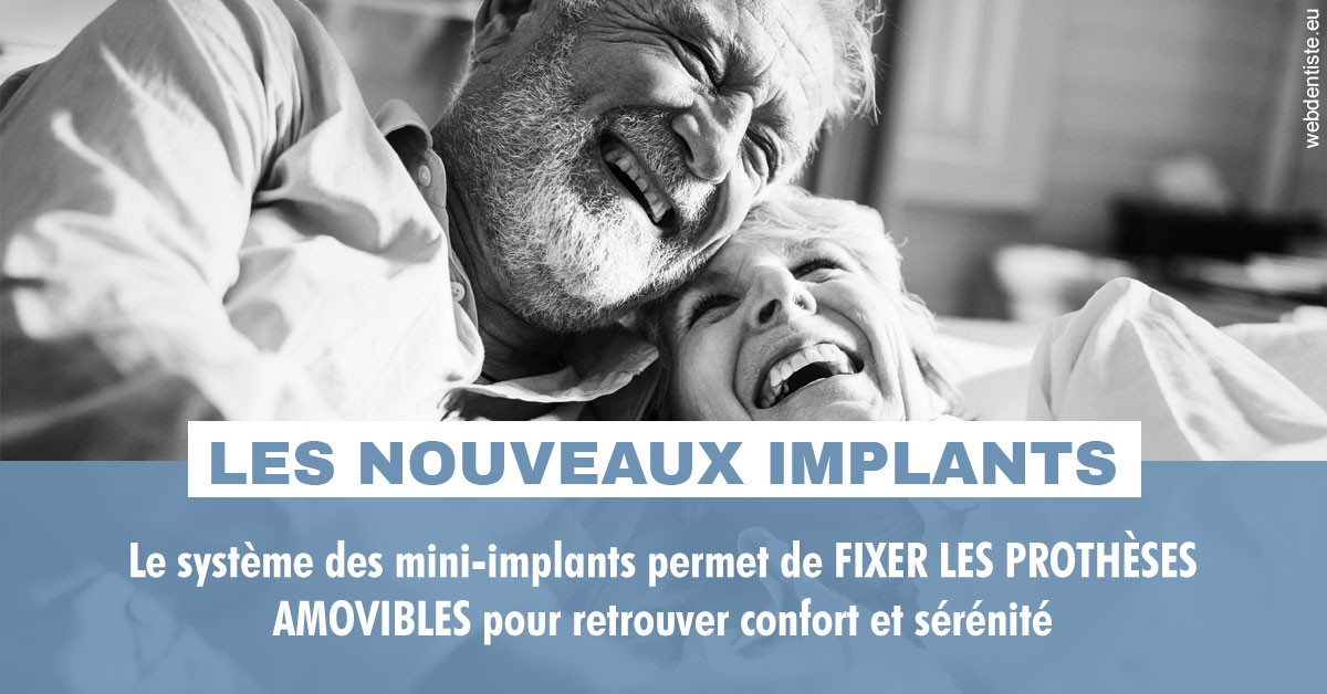 https://dr-laupie-julien.chirurgiens-dentistes.fr/Les nouveaux implants 2