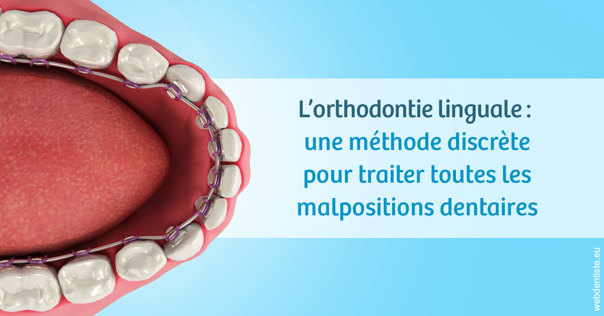 https://dr-laupie-julien.chirurgiens-dentistes.fr/L'orthodontie linguale 1