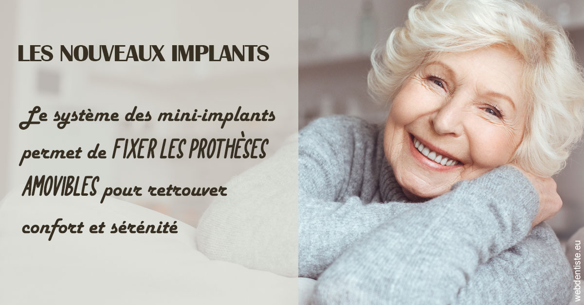 https://dr-laupie-julien.chirurgiens-dentistes.fr/Les nouveaux implants 1
