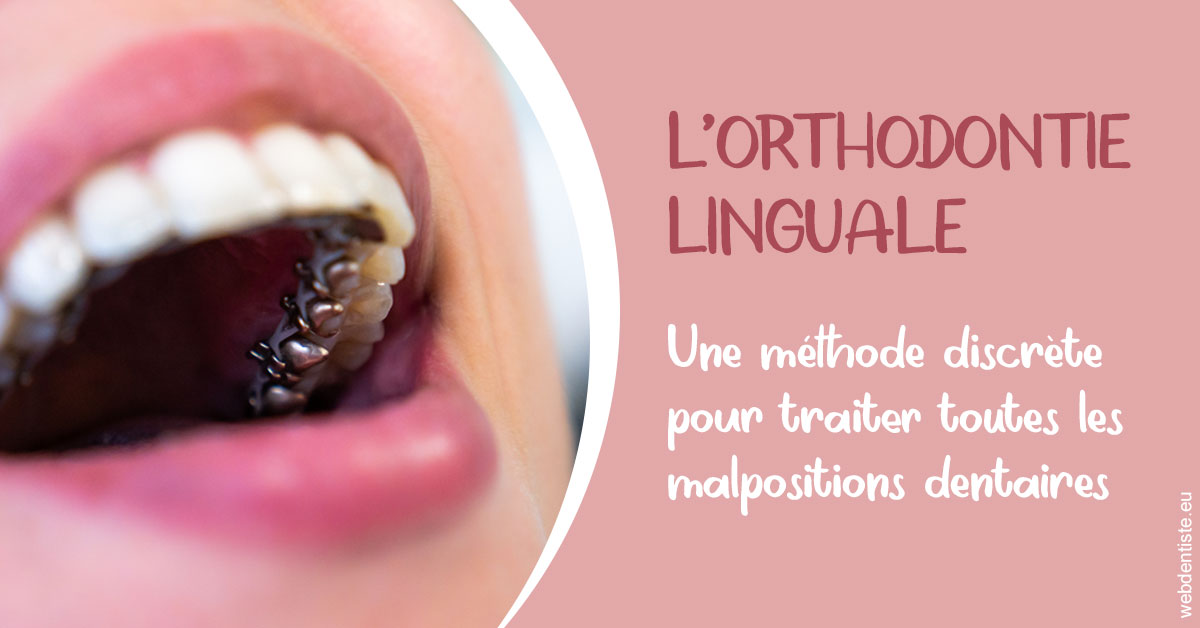 https://dr-laupie-julien.chirurgiens-dentistes.fr/L'orthodontie linguale 2