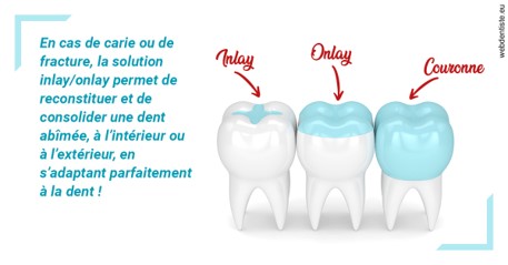 https://dr-laupie-julien.chirurgiens-dentistes.fr/L'INLAY ou l'ONLAY