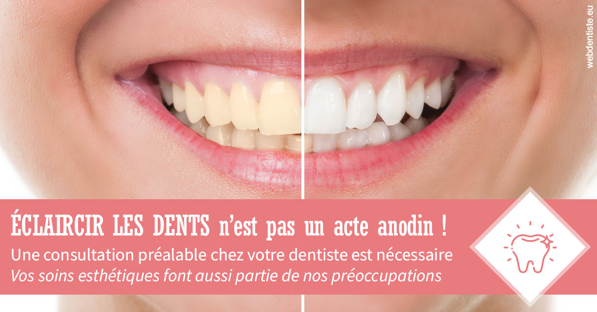 https://dr-laupie-julien.chirurgiens-dentistes.fr/Eclaircir les dents 1