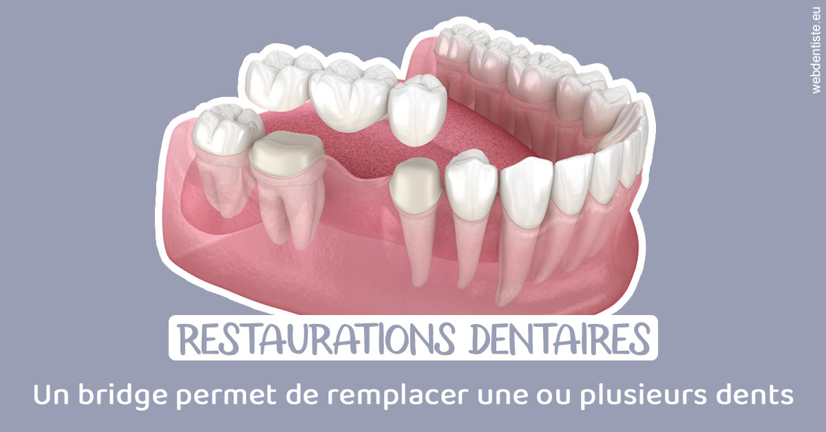 https://dr-laupie-julien.chirurgiens-dentistes.fr/Bridge remplacer dents 1