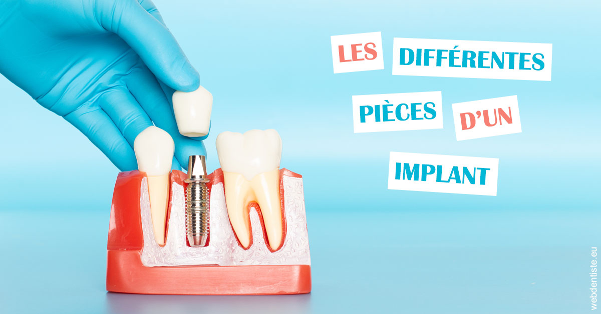 https://dr-laupie-julien.chirurgiens-dentistes.fr/Les différentes pièces d’un implant 2