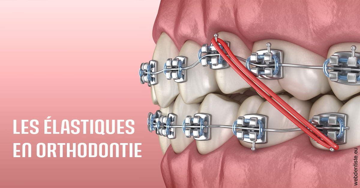https://dr-laupie-julien.chirurgiens-dentistes.fr/Elastiques orthodontie 2