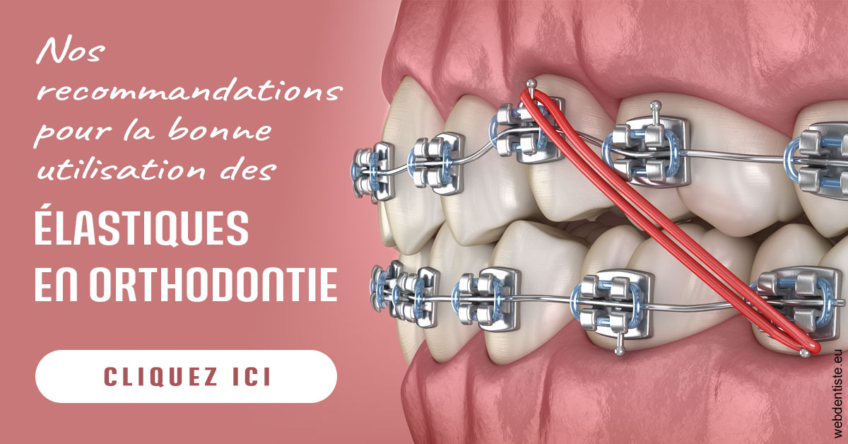 https://dr-laupie-julien.chirurgiens-dentistes.fr/Elastiques orthodontie 2